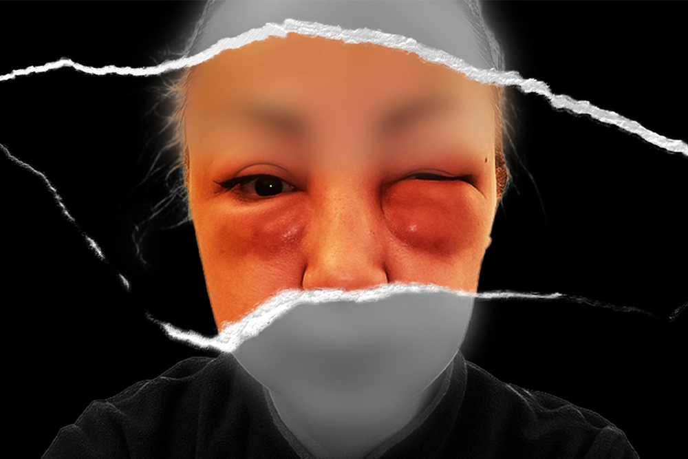 Azra Originalna fotografija stanja3