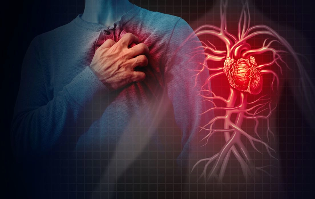 10 tisuća ljudi umire svaki dan u Europi od kardiovaskularnih bolesti